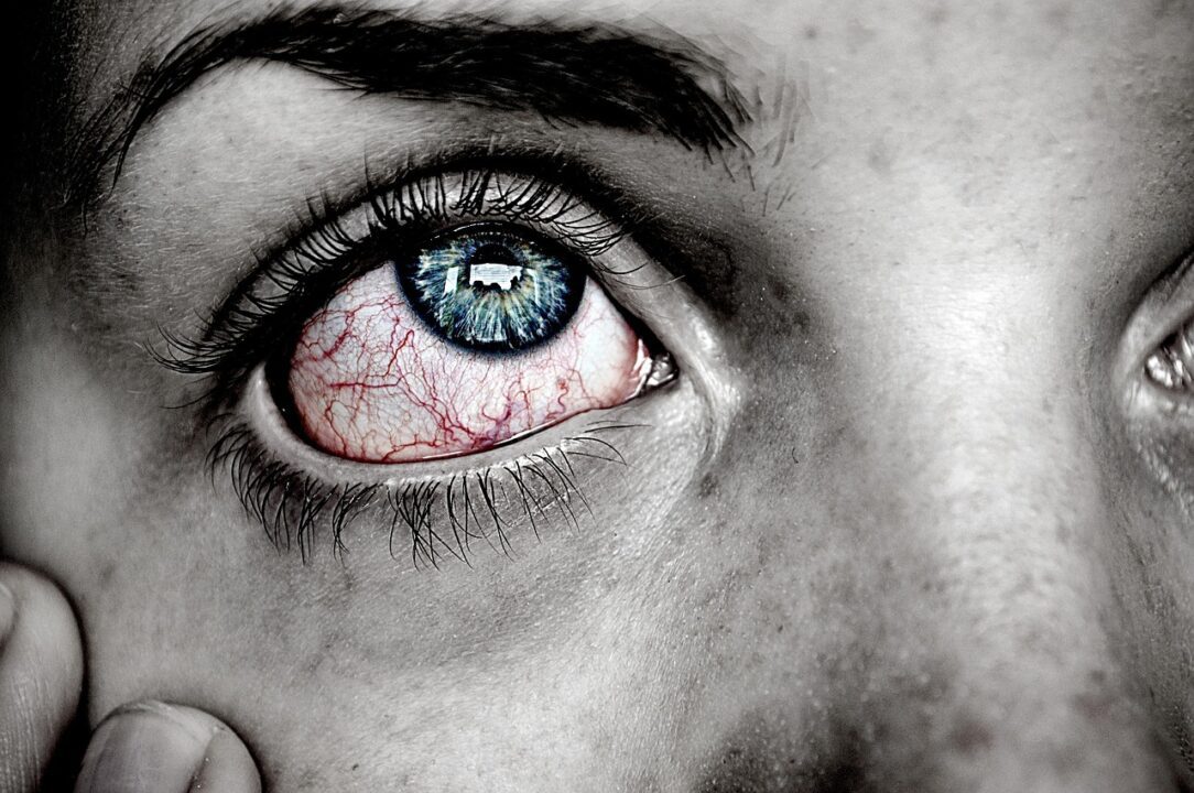 agnesliinnea eye