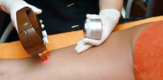 alterfines hair removal