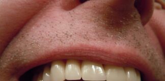 johnoaz teeth